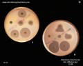 klebsiella pneumoniae ESBL evidence